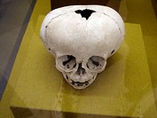Maya human skull intentionally deformed during childhood in museum, Mérida. Yucatán, Mexico