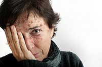Portrait of woman with skin spots