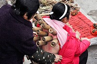 Yangshou China: a woman getting a Moxibustion treatment, a traditional Chinese medicine therapy with moxa mugwort herb, at the local market