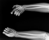 X-ray of hands.