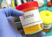 Doctor working with urine samples in a clinical laboratory.