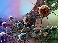 Digital 3d illustration of cancer cells in human body.