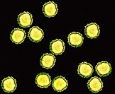 Purified coronavirus Covid-19 particles under transmission electron microscopy (TEM).