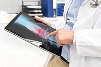 Unrecognizable Doctor is checking x-ray image at computer tablet, close up. Doctor at work in a hospital. Medicine and healthcare concept. High qualit...