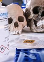 Several human skulls next to petri dish with bone remains to determine DNA in forensic laboratory.