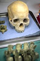 Skull adult person in murder investigation in a forensic laboratory, conceptual image.