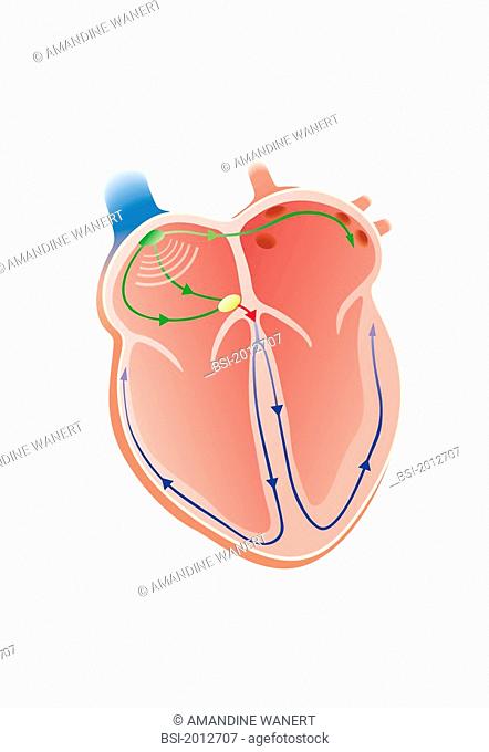 Electrical activity of the heart. Sinus node at the top of the right atrium, in green, auriculoventricular node between the right atrium and the right ventricle
