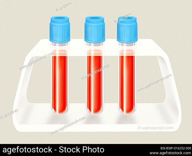 Support of test tubes for blood samples. This Plexiglas support can accommodate up to 3 test tubes