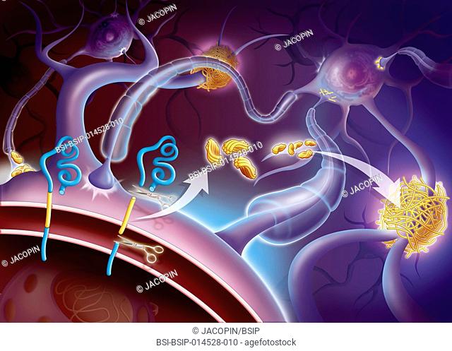 Illustration of amyloid plaques forming. From the APP membrane protein (amyloid precursor protein), two enzymes, alpha secretase and beta secretase