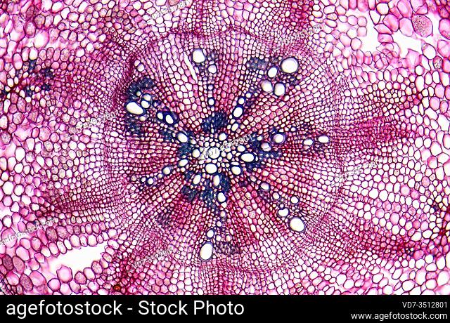 Stem, cross section showing xylem, endodermis and parenchyma. Photomicrograph