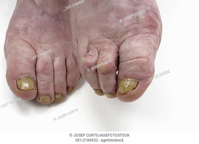 Old woman's feet