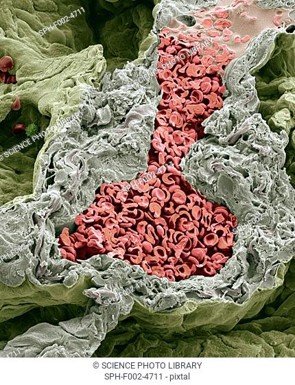 Blood vessel in the lung, SEM