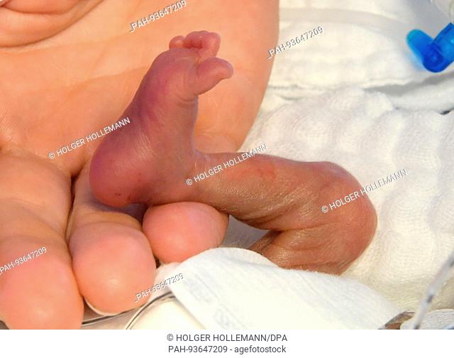 dpatop - The right foot of a 5-day-old boy who weighed 430 grams at birth, in the hand of a nurse, at the children's clinic of Hannover Medical School...