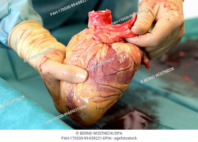 Transplant surgeon Frank-Peter Nitschke, Managing Director of the Mecklenburg-Western Pomerania Tissue Bank(GTM-V), holds in his hands a heart which he had just...