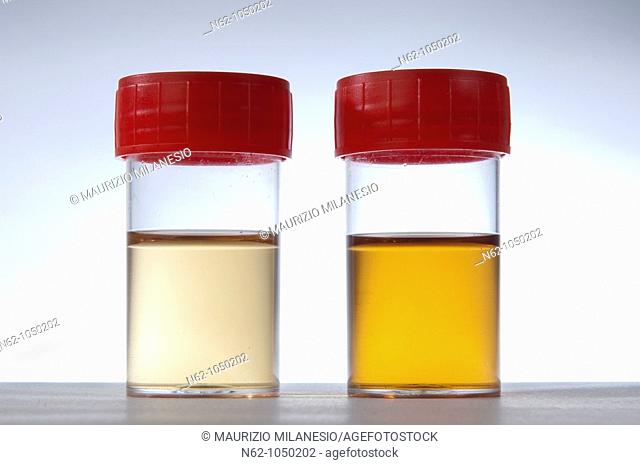 Tube urine prepared for testing