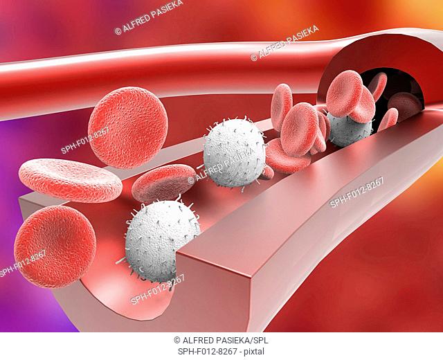 Human artery, cut-away computer artwork, showing the artery wall and red and white blood cells