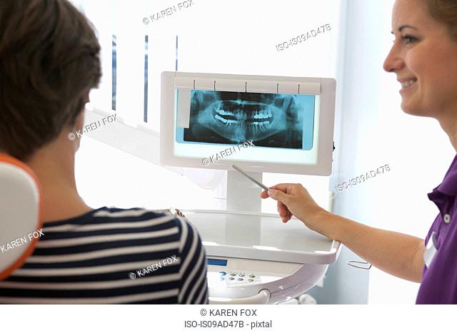 Patient looking at xray of dental implants