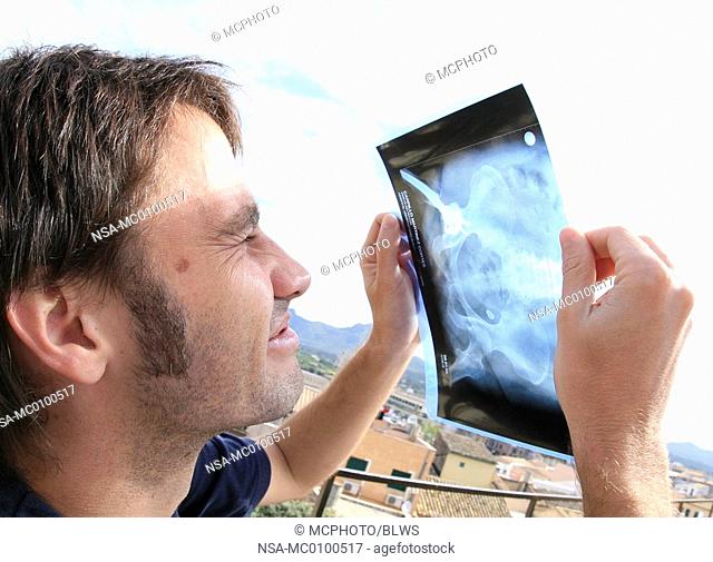 young man watching sun eclipse through a roentgenogram showing an artificial ilium