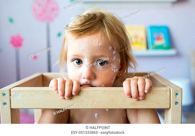 Little two year old girl at home sick with chickenpox, sitting in wooden chair. White antiseptic cream applied to the rash