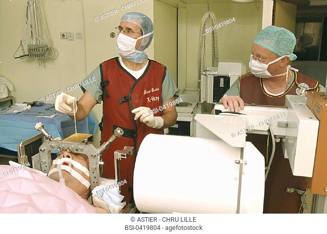 BRAIN ELECTROSTIMULATION<BR>Photo essay from hospital.<BR>The operation is generally executed under local anesthesia, except in cases like this one