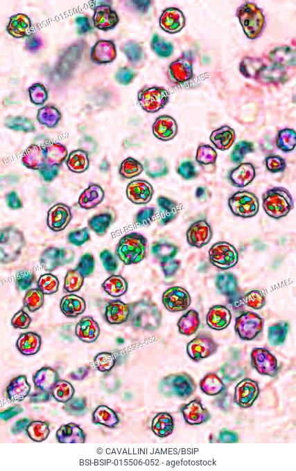 The measles virus (paramyxoviridae from the Morbillivirus family). Image taken from a transmission microscopy view