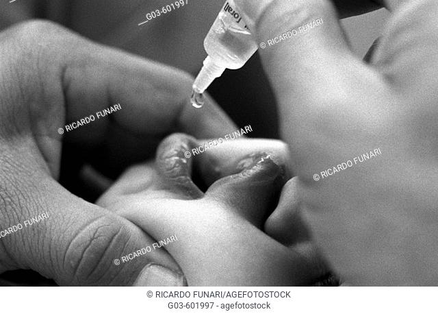 Child takes vaccine against poliomyelitis or infantile paralysis, a serious infectious disease of the nerves in ths spine