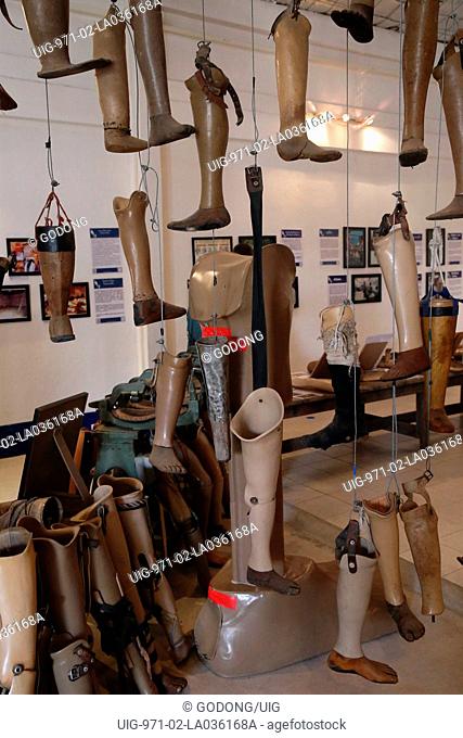 Various prostheses are pictured at the documentation and rehabilitation center COPE for victims of mines and cluster munition. Vientiane. Laos