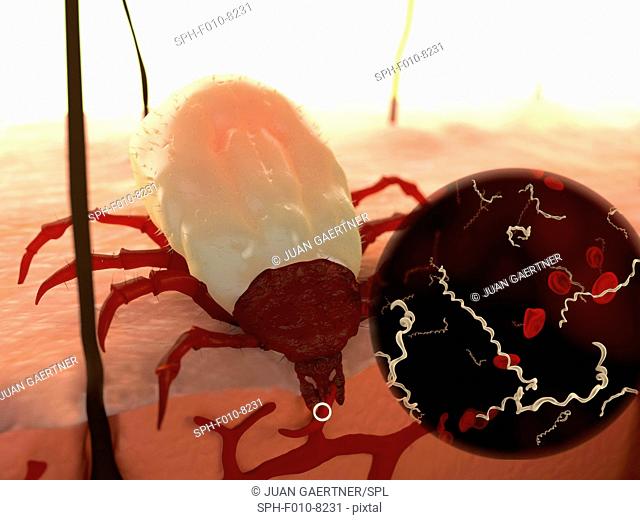 Tick feeding, illustration. Ticks (superfamily Ixodoidea) are external parasites that feed on human and animal blood. Their bite can transmit a number of...