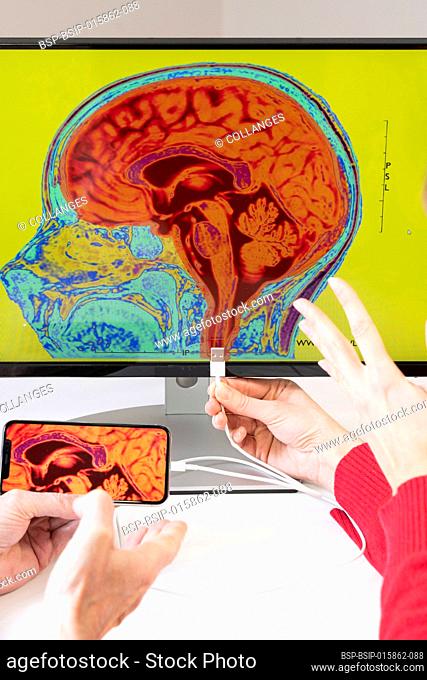 Close-up of hands showing how to connect a smartphone to a brain depicted in a medical image
