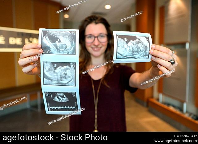 A happy and confident young woman is seen close up, holding the ultrasound images of a healthy 6 week old baby boy fetus