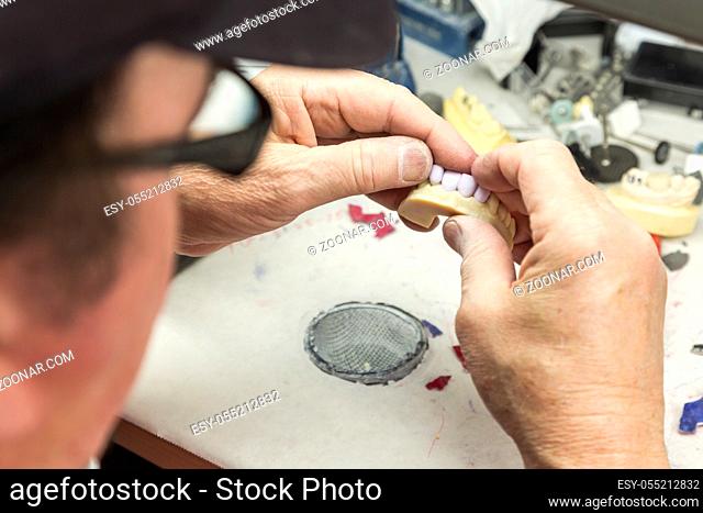 Male Dental Technician Working On A 3D Printed Mold For Tooth Implants In The Lab