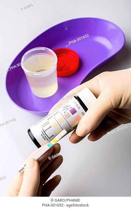 Urine sample with a test strip showing the results. This urine analysis is used to test for urinary tract infections
