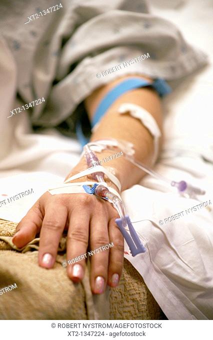 A womans arm and hand with IV tubes and tape in a hospital bed
