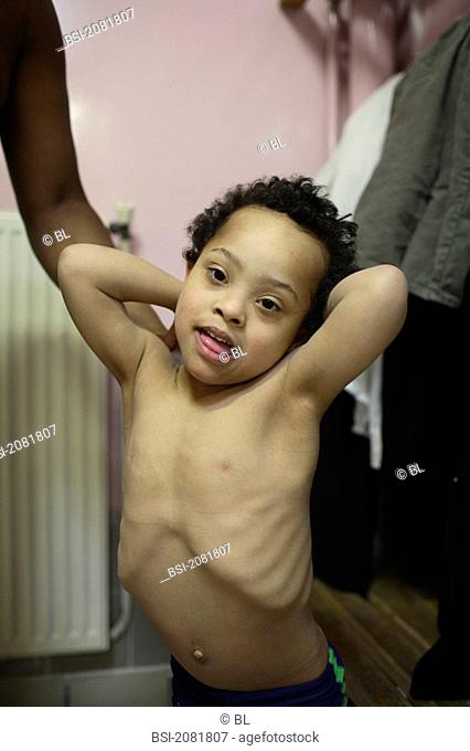 4-year-old boy with down's syndrome with his father in the cloak room of the swimming pool Hébert Paris