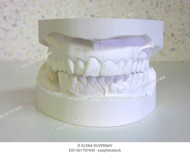 White plaster mouth