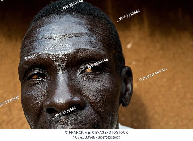 Man belonging to the Nuer tribe with traditional scars on his forehead. Gambela state in Ethiopia