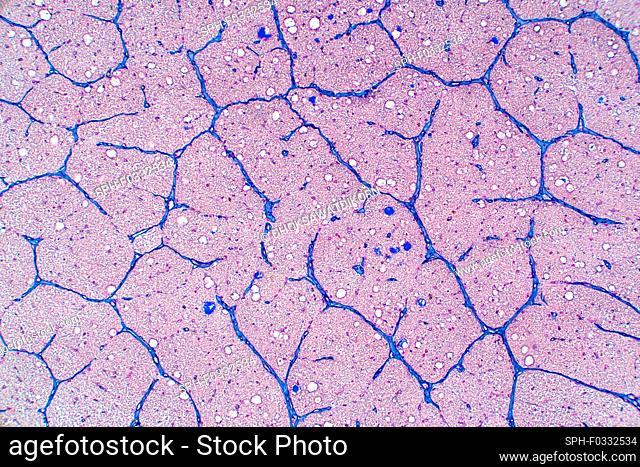 Human optic nerve, light micrograph