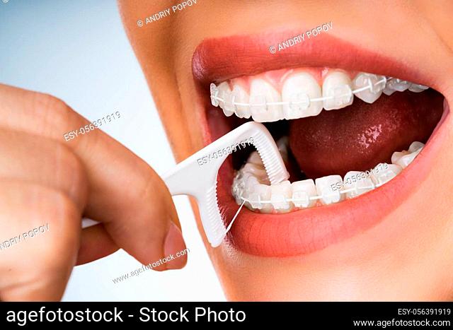 Female Cleaning Dental Brackets In Mouth Using Floss Stick