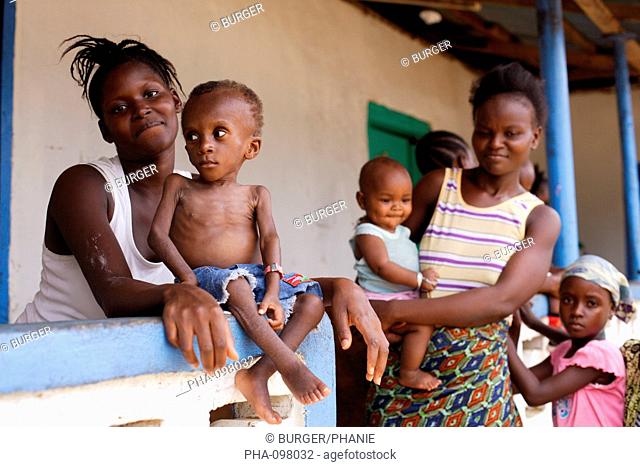 18 months old undernourished child suffering from marasmus with his mother in a Therapeutic Feeding Center in Monrovia, Liberia