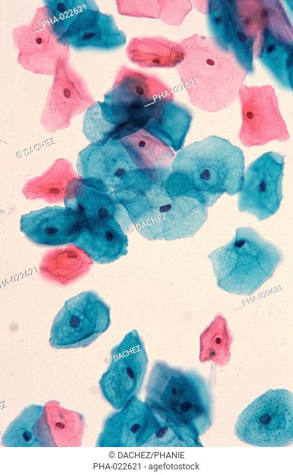 Light microscopy of cervical smear showing normal epithelial cells