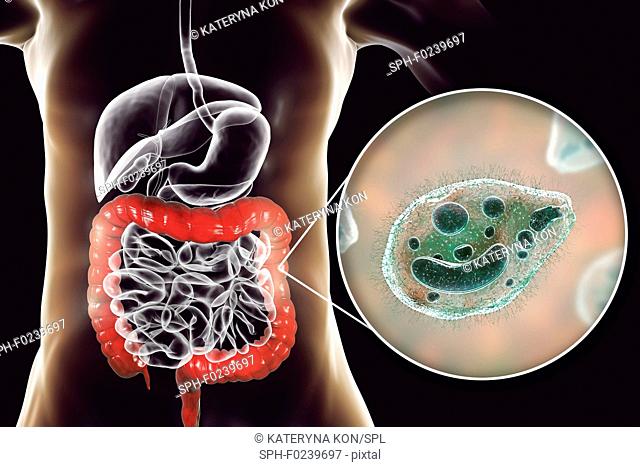 Balantidiasis, conceptual image. Computer illustration showing close-up view of ciliate protozoan Balantidium coli, an intestinal parasite the causative agent...