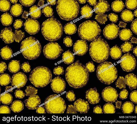 detail of ultraestructure of deadly coronavirus particles under transmission electron microscopy (TEM)