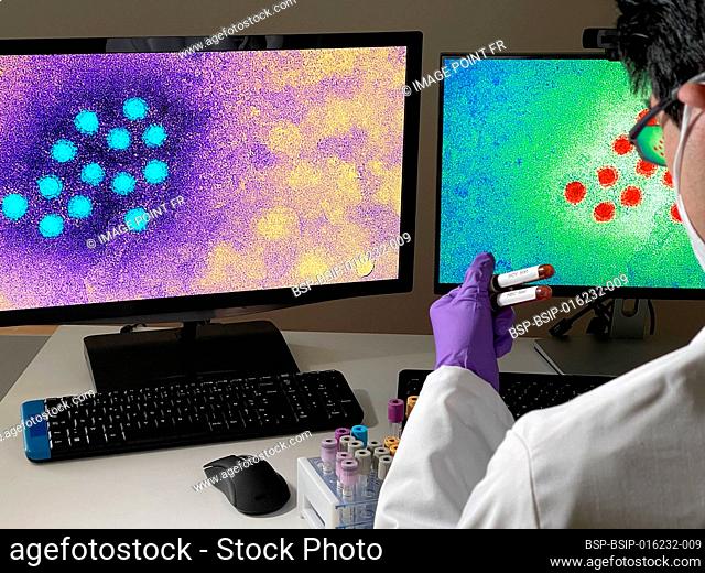 Laboratory technician doing research with images of hepatitis A virus on computer