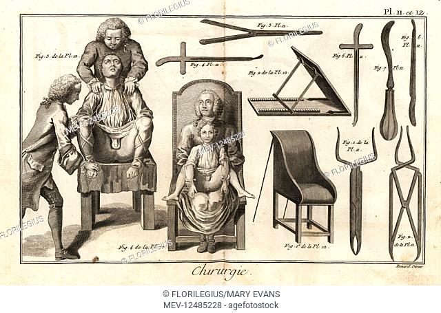 Surgical chairs with patients held in place for a bladder stone operation through the groin, Plate 12. Surgical instruments including dilators 1-3