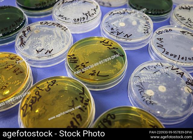 30 September 2022, Syria, Idlib: Cholera positive samples (yellow) are pictured in a medical laboratory of the Early Warning