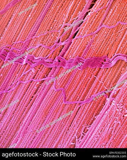 Tendon, coloured scanning electron micrograph (SEM), showing bundles of collagen fibres. The parallel alignment of the fibres make tendons inelastic but...