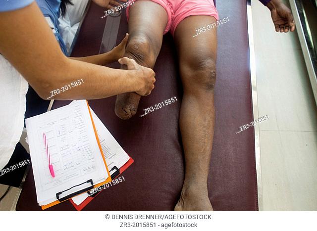 Victims of land mines are attended to at a hospital in Phnom Penh, Cambodia administered by the NGO Cambodia Trust