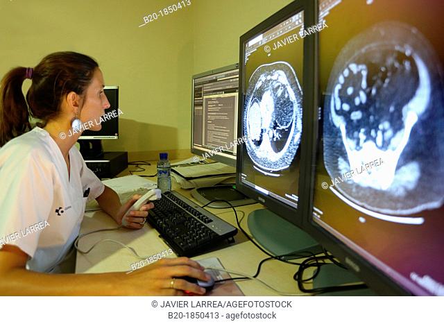 Abdominopelvic CT scan, Radiology Interpretation Review, Radiology Department, Donostia Hospital, San Sebastian, Donostia, Gipuzkoa, Basque Country, Spain