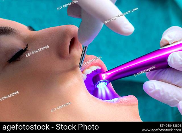 Macro close up of hand working on female teeth with blue led curing light