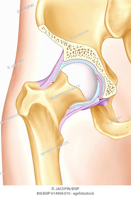 Illustration of the hip joint. The two joint surfaces (grey) are visible, the pelvic joint cavity (acetabulum) and the femur proximal epiphysis (femoral head)